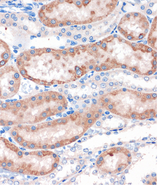 Immunohistochemistry of paraffin-embedded Rat kidney using CHDH Rabbit pAb  at dilution of 1:100 