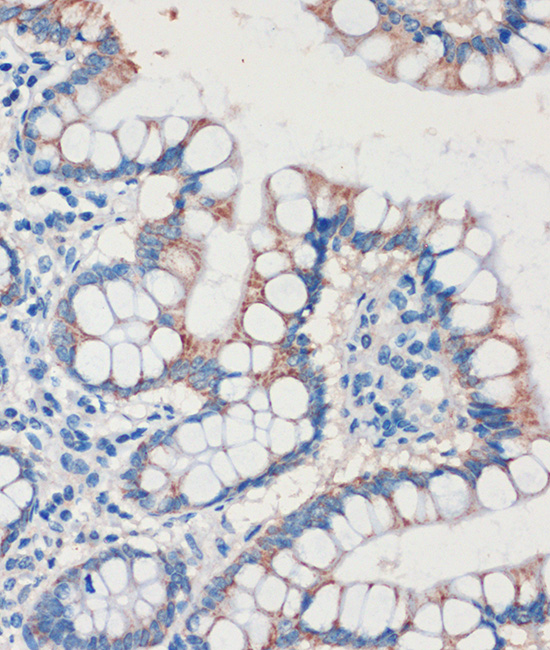 a10927 chdh primary antiboties ihc testing 4