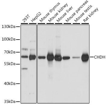Western blot analysis of extracts of various cell lines, using CHDH antibody  at 1:1000 dilution