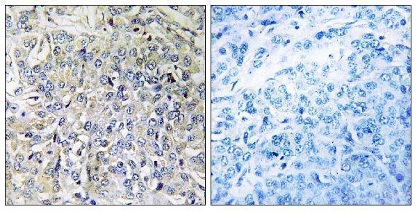 a10939 csgalnact2 primary antibodies ihc testing 1