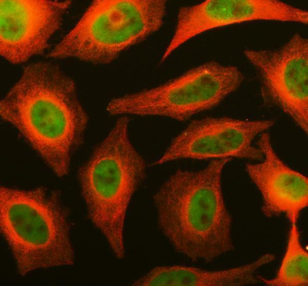 a10940 1 fbxo28 primary antibodies if testing 1