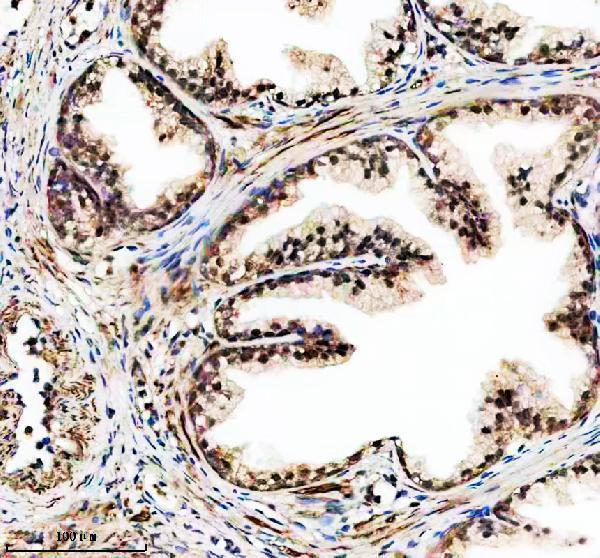 IHC analysis of FBXO28 using anti-FBXO28 antibody (A10940-1)