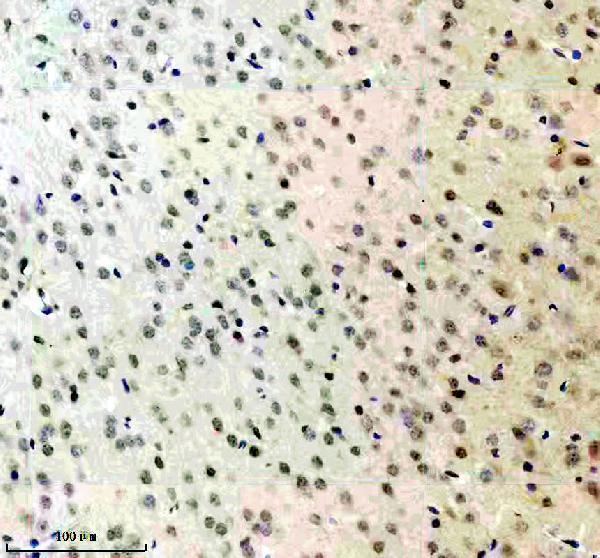 IHC analysis of FBXO28 using anti-FBXO28 antibody (A10940-1)
