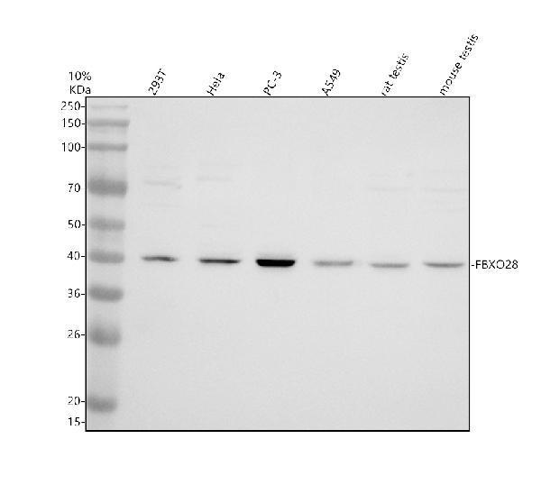 Western blot analysis of FBXO28 using anti-FBXO28 antibody (A10940-1)