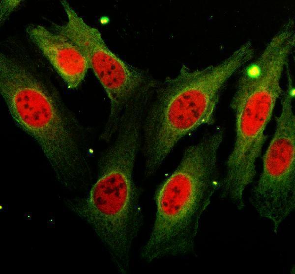 a10945 2 foxj3 primary antibodies if testing 1