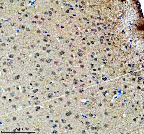 IHC analysis of FOXJ3 using anti-FOXJ3 antibody (A10945-2)