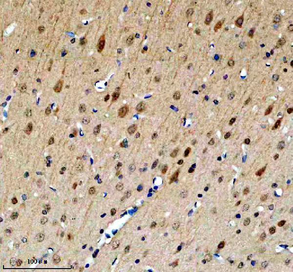 IHC analysis of FOXJ3 using anti-FOXJ3 antibody (A10945-2)