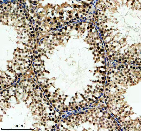 a10945 2 foxj3 primary antibodies ihc testing 3