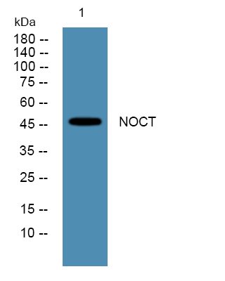 Western blot analysis of lysates from PC12 cells, primary antibody was diluted at 1:1000, 4°over night