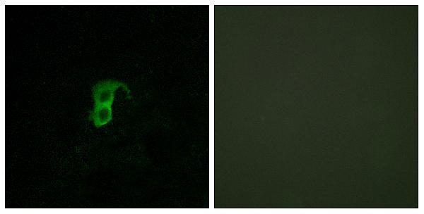 Immunofluorescence analysis of HUVEC cells, using GPR87 Antibody