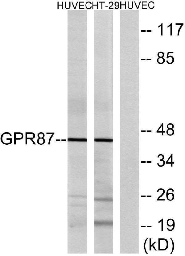 Western blot analysis of lysates from HUVEC and HT-29 cells, using GPR87 Antibody