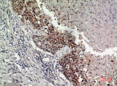 Immunohistochemical analysis of paraffin-embedded human-lung, antibody was diluted at 1:100