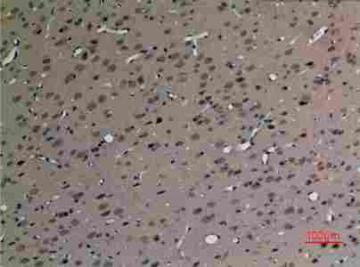 a10958 sv2c primary antibodyes ihc testing 2