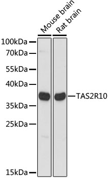 Western blot analysis of extracts of various cell lines, using TAS2R10 antibody  at 1:1000 dilution