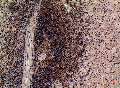 a10961 lilrb5 primary antibodies ihc testing 1