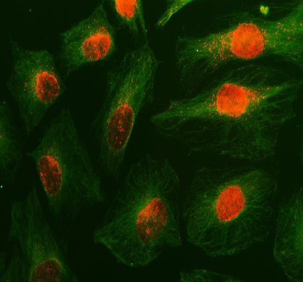 a10963 1 med22 primary antibodies if testing 1
