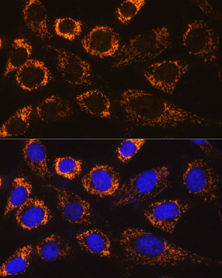 Immunofluorescence analysis of NIH/3T3 cells using P4HA3 Rabbit pAb  at dilution of 1:100