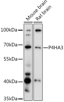 Western blot analysis of extracts of various cell lines, using P4HA3 antibody  at 1:3000 dilution