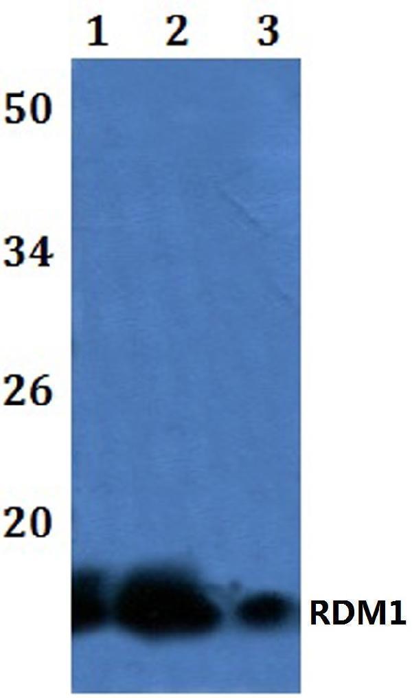 Western blot (WB) analysis of RDM1 polyclonal antibody at 1:500 dilution
Lane1:HEK293T whole cell lysate
Lane2:Raw264