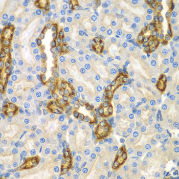 Immunohistochemistry of paraffin-embedded mouse kidney using CNPY3 antibody  at dilution of 1:100 
