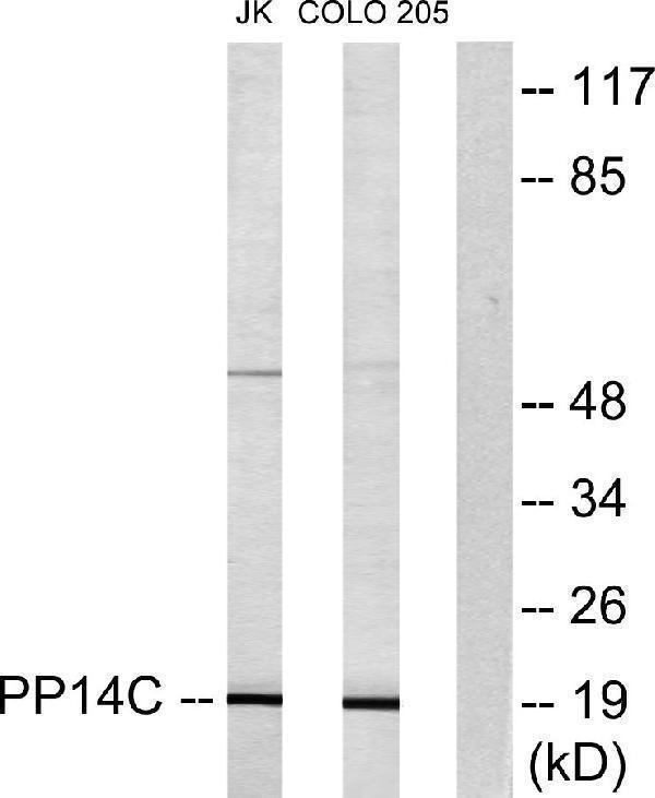 Western blot analysis of lysates from Jurkat and COLO205 cells, using PPP1R14C Antibody