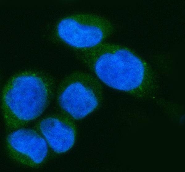 a10975 1 ifi44l primary antibodies if testing 4