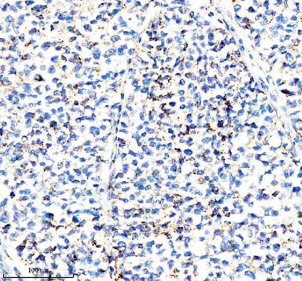  IHC analysis of IFI44L using anti-IFI44L antibody (A10975-1)