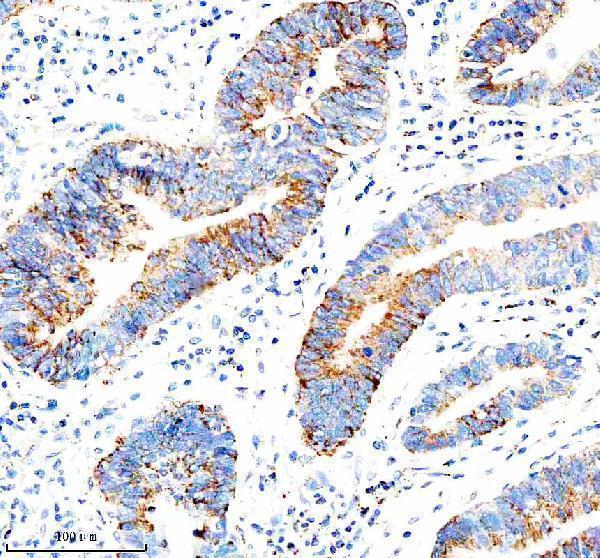  IHC analysis of IFI44L using anti-IFI44L antibody (A10975-1)