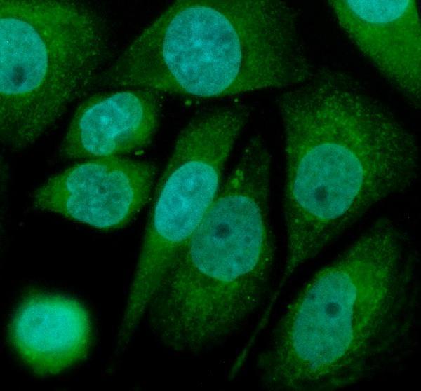 IF analysis of SLC25A17 using anti-SLC25A17 antibody (A10976-2)
