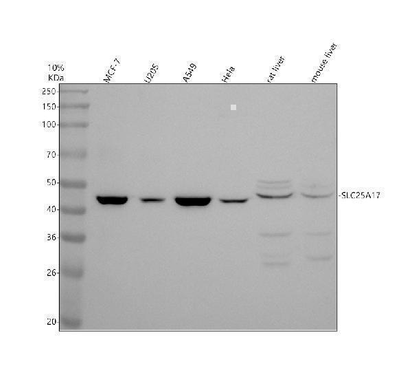 Western blot analysis of SLC25A17 using anti-SLC25A17 antibody (A10976-2)
