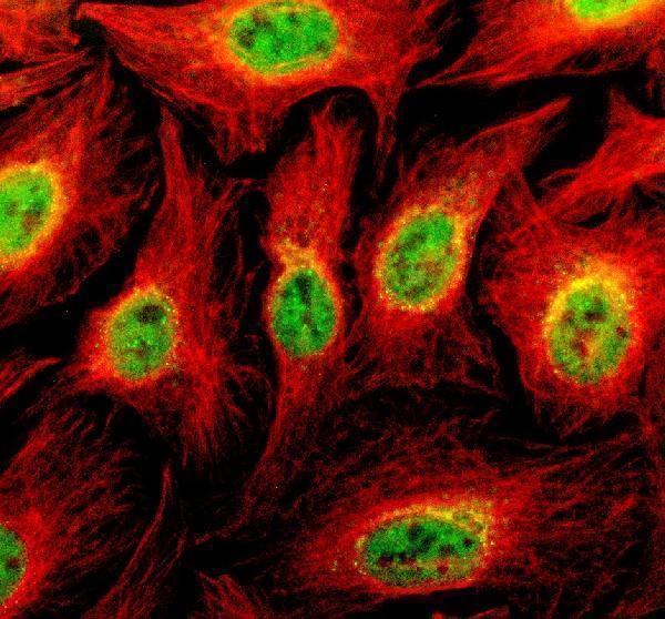 IF analysis of TBKBP1 using anti-TBKBP1 antibody (A10984-1) and anti-Beta Tubulin antibody (M01857-3)