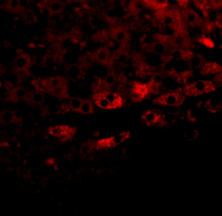 a10984 tbkbp1 primary antibodies if testing 3