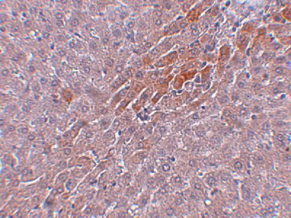 a10984 tbkbp1 primary antibodies ihc testing 2
