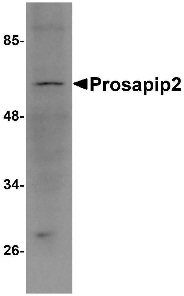 a10984 tbkbp1 primary antibodies wb testing 1