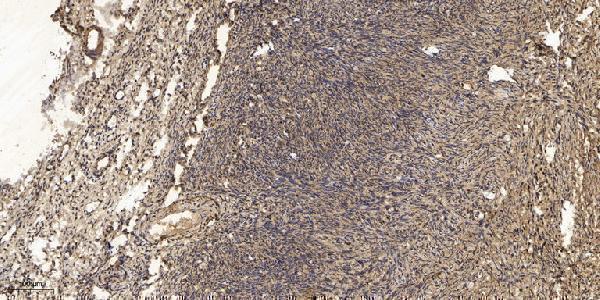 a10986 prokr1 primary antibodies ihc testing 1