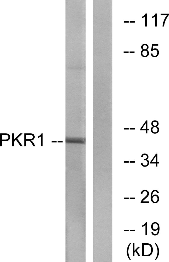 a10986 prokr1 primary antibodies wb testing 3
