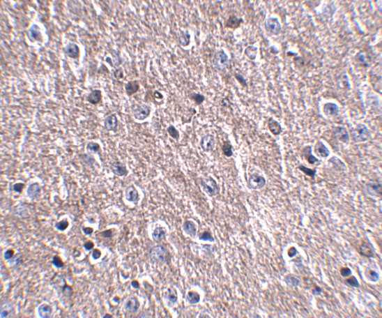 a10988 cdip1 primary antibodies ihc testing 2