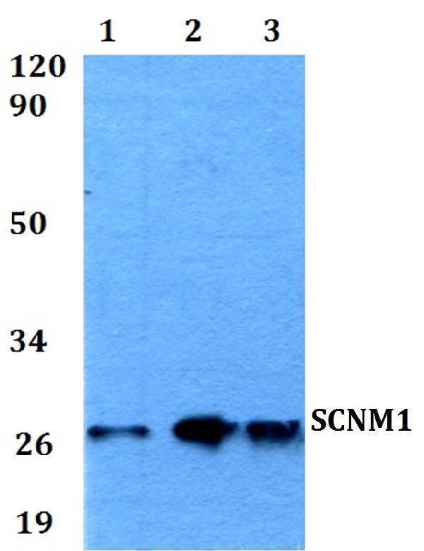 a10999 scnm1 primary antiboties wb testing 1