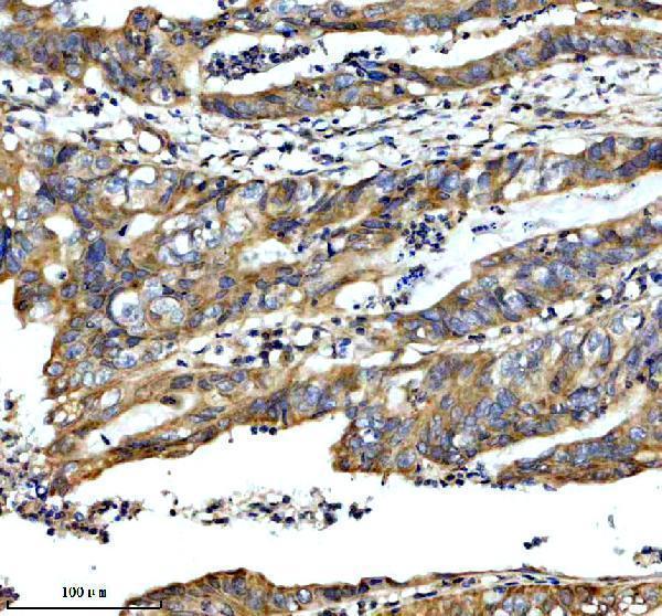 IHC analysis of GALK2 using anti-GALK2 antibody (A11000)