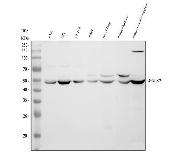 Western blot analysis of GALK2 using anti-GALK2 antibody (A11000)