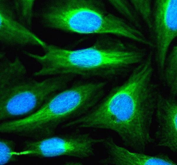 a11003 3 snx16 primary antibodies if testing 1