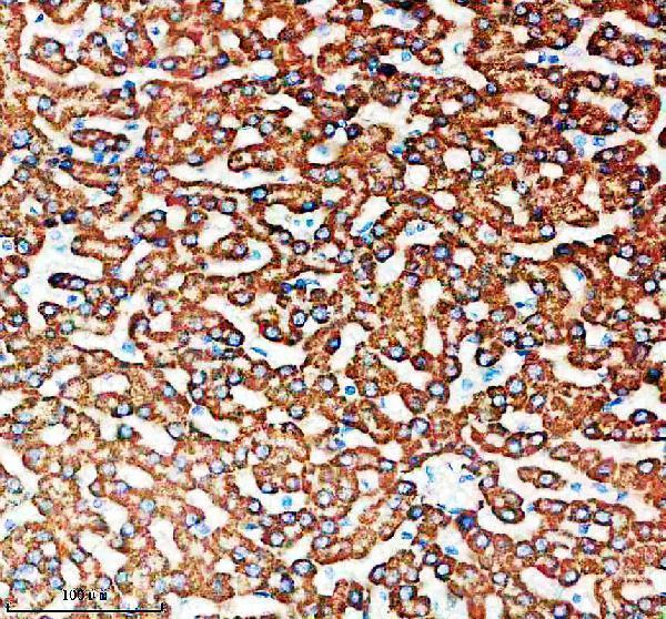 IHC analysis of SNX16 using anti-SNX16 antibody (A11003-3)