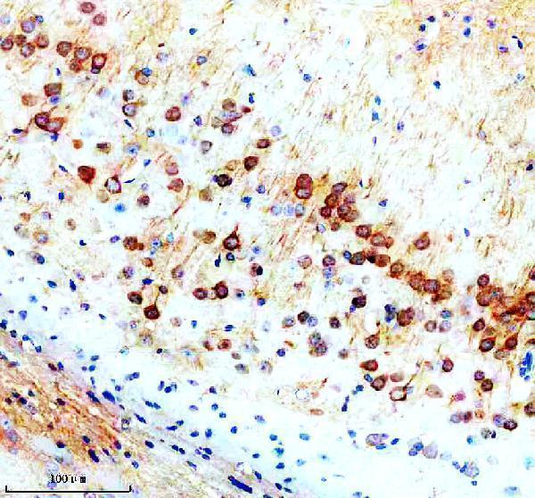 IHC analysis of SNX16 using anti-SNX16 antibody (A11003-3)