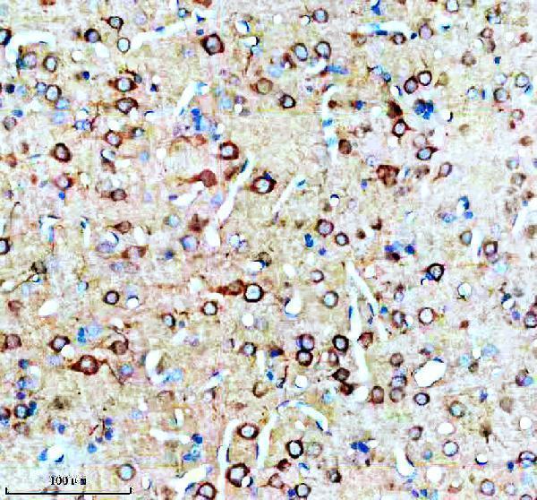 a11003 3 snx16 primary antibodies ihc testing 3
