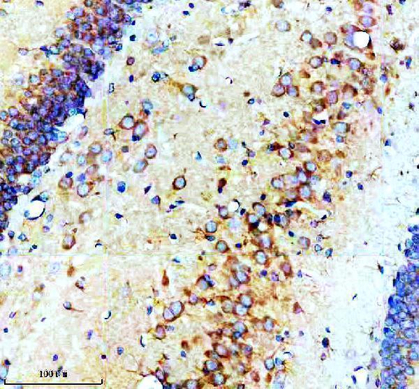 a11003 3 snx16 primary antibodies ihc testing 4