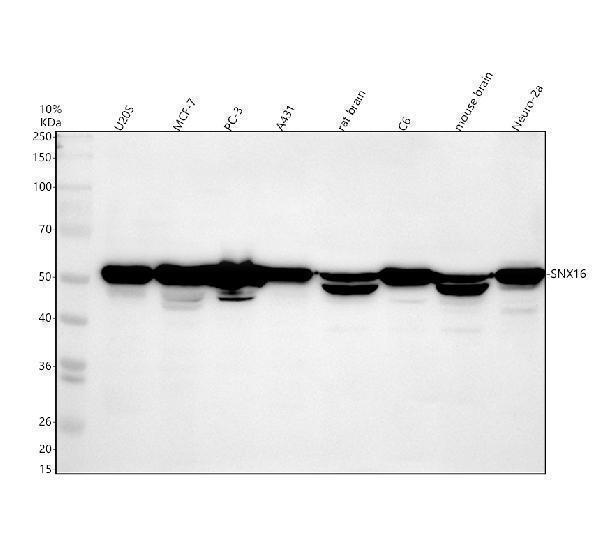 Western blot analysis of SNX16 using anti-SNX16 antibody (A11003-3)