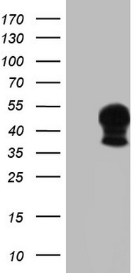 HEK293T cells were transfected with the pCMV6-ENTRY control (Left lane) or pCMV6-ENTRY SNX16 (Right lane) cDNA for 48 hrs and lysed. Equivalent amounts of cell lysates (5 ug per lane) were separated by SDS-PAGE and immunoblotted with Rabbit. HEK293T cells were transfected with the pCMV6-ENTRY control (Left lane) or pCMV6-ENTRY SNX16 (Right lane) cDNA for 48 hrs and lysed. Equivalent amounts of cell lysates (5 ug per lane) were separated by SDS-PAGE and immunoblotted with Rabbit.