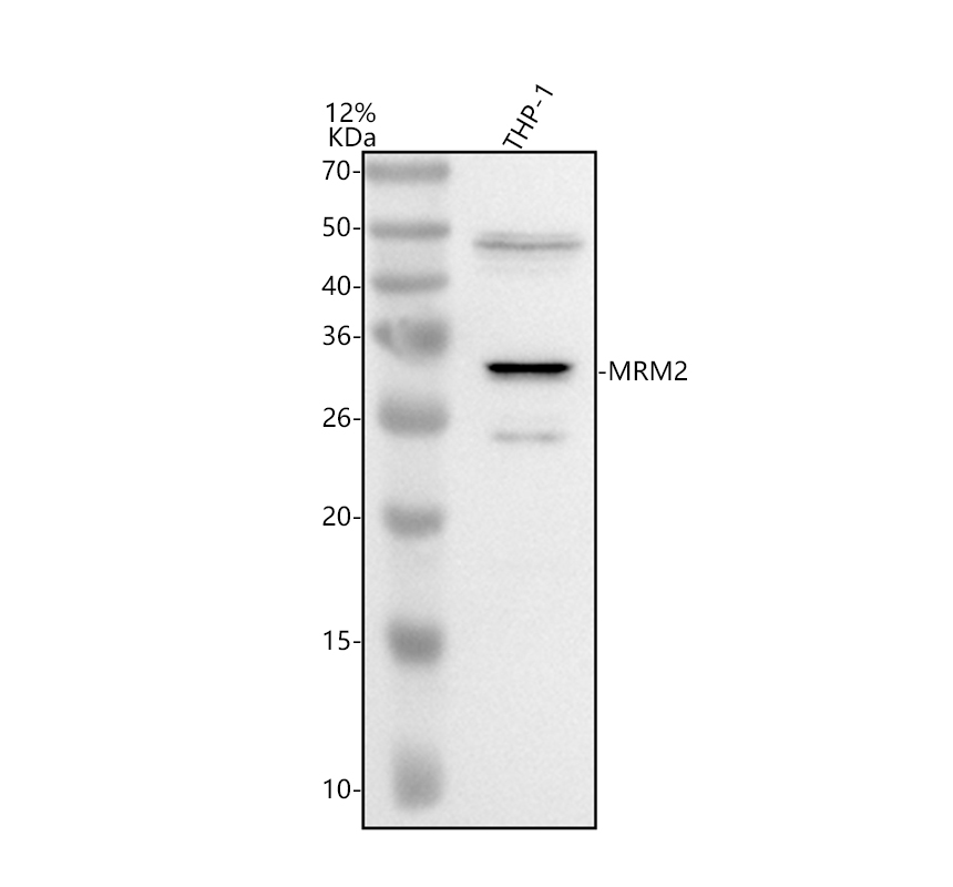 Western blot analysis of FTSJ2/MRM2 using anti-FTSJ2/MRM2 antibody (A11004)