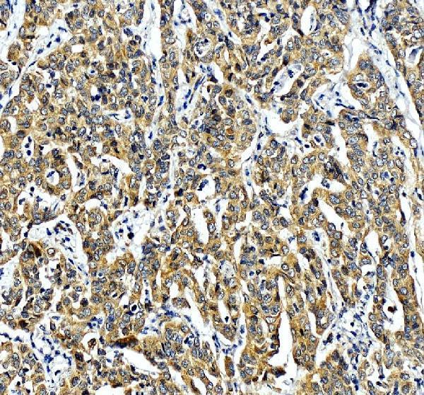 IHC analysis of ERGIC1 using anti-ERGIC1 antibody (A11007-1)