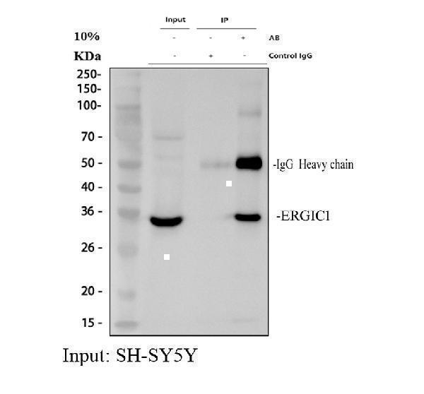 a11007 1 ergic1 primary antibodies ip testing 1